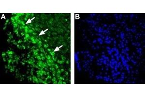Expression of Histamine H1 receptor in mouse brainImmunohistochemical staining of mouse ventromedial hypothalamus (VMH) using Anti-Histamine H1 Receptor (HRH1) Antibody (ABIN7043268, ABIN7044505 and ABIN7044506). (Histamine Receptor H1 (HRH1) Peptid)