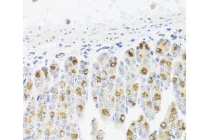 Immunohistochemistry of paraffin-embedded Mouse stomach using CDC45 Polyclonal Antibody at dilution of 1:100 (40x lens). (CDC45 Antikörper)