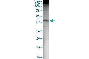 Immunoprecipitation (IP) image for anti-DnaJ (Hsp40) Homolog, Subfamily B, Member 6 (DNAJB6) (AA 1-326) antibody (ABIN523420)