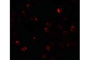 Immunofluorescence of ZBTB40 in Raji cells with ZBTB40 antibody at 20 µg/ml. (ZBTB40 Antikörper  (N-Term))
