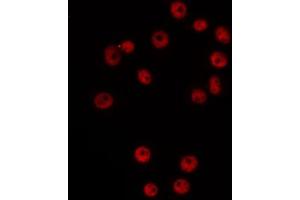 ABIN6266525 staining Hela by IF/ICC. (Cyclin G1 Antikörper  (Internal Region))