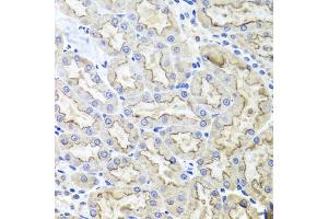 Immunohistochemistry of paraffin-embedded rat kidney using LRP2 antibody (ABIN1680712, ABIN3017881, ABIN3017882 and ABIN6220293) at dilution of 1:100 (40x lens). (LRP2 Antikörper  (AA 4446-4655))