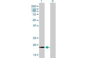 Western Blot analysis of CETN2 expression in transfected 293T cell line by CETN2 MaxPab polyclonal antibody. (CETN2 Antikörper  (AA 1-172))