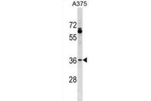 Western Blotting (WB) image for anti-Olfactory Receptor, Family 51, Subfamily T, Member 1 (OR51T1) antibody (ABIN3000143) (OR51T1 Antikörper)