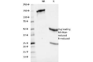 SDS-PAGE Analysis Purified HLA-ABC Mouse Monoclonal Antibody (246-B8. (HLA-ABC Antikörper)