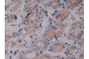 DAB staining on IHC-P; Samples: Human Stomach Tissue (LTBP2 Antikörper  (AA 522-814))