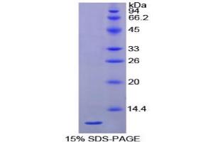 SDS-PAGE analysis of Chicken HSPA8 Protein.