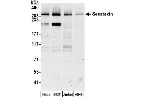 anti-Senataxin (SETX) (AA 875-925) antibody