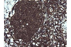 Image no. 2 for anti-V-Ets Erythroblastosis Virus E26 Oncogene Homolog 2 (ETS2) (AA 90-349) antibody (ABIN1491703) (ETS2 Antikörper  (AA 90-349))