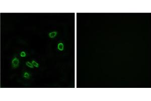 Immunofluorescence analysis of A549 cells, using BRP44L antibody. (BRP44L Antikörper)