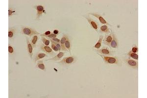 Immunocytochemistry analysis of Hela cells using ABIN7139204 at dilution of 1:100 (HIST1H3A Antikörper  (acLys9))