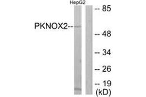 Western blot analysis of extracts from HepG2 cells, using PKNOX2 Antibody. (PKNOX2 Antikörper  (AA 341-390))