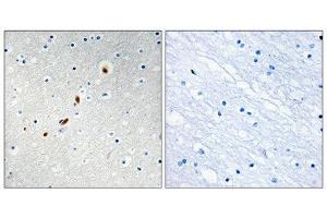 Immunohistochemistry (IHC) image for anti-Zinc Finger Protein 596 (ZNF596) (Internal Region) antibody (ABIN1849812) (ZNF596 Antikörper  (Internal Region))