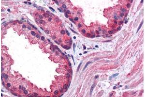 Human Prostate: Formalin-Fixed, Paraffin-Embedded (FFPE) (CCNDBP1 Antikörper  (AA 348-360))