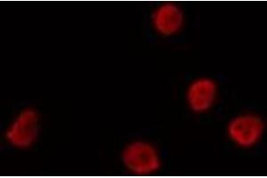 ABIN6275719 staining Hela by IF/ICC. (SMUG1 Antikörper  (Internal Region))