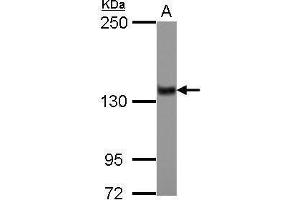 WB Image Sample (30 ug of whole cell lysate) A: IMR32 5% SDS PAGE antibody diluted at 1:1000 (ZNF217 Antikörper)