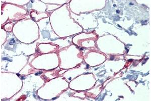 Adipocytes, Human: Formalin-Fixed, Paraffin-Embedded (FFPE) (NFIC Antikörper  (AA 323-372))