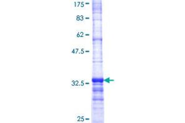 GSTA4 Protein (AA 168-222) (GST tag)