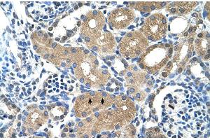 Human kidney (PPAP2A Antikörper  (N-Term))