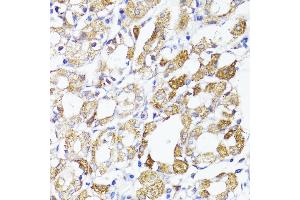 Immunohistochemistry (IHC) image for anti-Mitochondrial Antiviral Signaling Protein (MAVS) (AA 1-65) antibody (ABIN6143583)