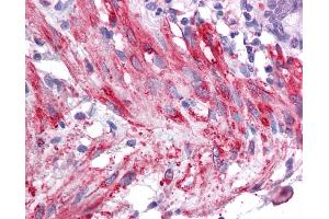 Immunohistochemistry (IHC) image for anti-Sirtuin 5 (SIRT5) (Middle Region) antibody (ABIN2778620) (SIRT5 Antikörper  (Middle Region))