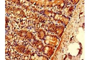 Immunohistochemistry of paraffin-embedded human small intestine tissue using ABIN7151962 at dilution of 1:100 (EPN3 Antikörper  (AA 25-208))