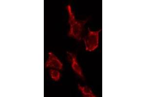 ABIN6275173 staining LOVO cells by IF/ICC.