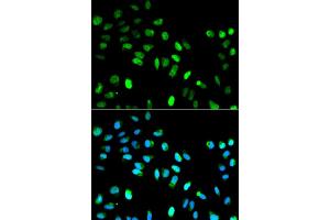 Immunofluorescence analysis of HeLa cell using MAD1L1 antibody. (MAD1L1 Antikörper)