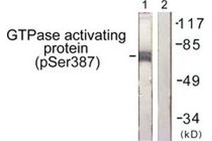 Western blot analysis of extracts from COS7 cells, using GTPase Activating Protein (Phospho-Ser387) Antibody. (RACGAP1 Antikörper  (pSer387))