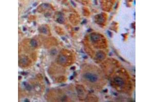 Used in DAB staining on fromalin fixed paraffin-embedded Liver tissue (KNG1 Antikörper  (AA 22-379))