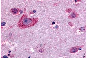 Anti-Delta Opioid Receptor antibody  ABIN1048497 IHC staining of human brain, neurons and glia. (OPRD1 Antikörper  (C-Term))