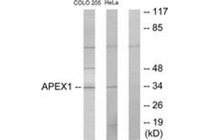 Western blot analysis of extracts from COLO205/HeLa cells, using APEX1 Antibody. (APEX1 Antikörper  (AA 191-240))