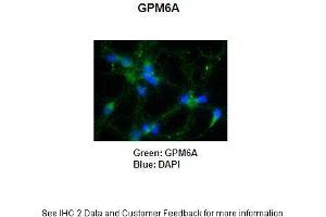 Primary Antibody Dilution: 1:250Secondary Antibody: Anti-rabbit-AlexaFluor 488 Secondary Antibody Dilution: 1:5000Color/Signal Descriptions: GPM6A: Green DAPI: Blue  Gene Name: GPM6A Submitted by: Anonymous