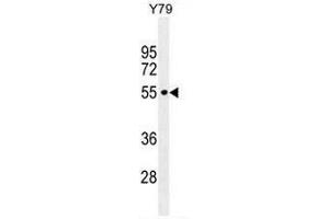 CCDC97 Antibody (C-term) western blot analysis in Y79 cell line lysates (35µg/lane). (CCDC97 Antikörper  (C-Term))