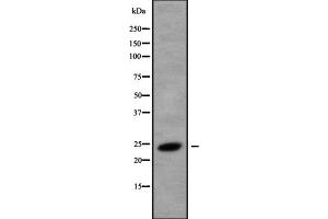 Western blot analysis of CREG1 using K562 whole cell lysates (CREG1 Antikörper  (C-Term))