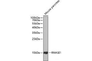 Western blot analysis of extracts of Mouse pancreas using RNASE1 Polyclonal Antibody at dilution of 1:1000. (RNASE1 Antikörper)