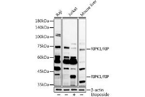 RIPK1 antibody  (AA 170-440)
