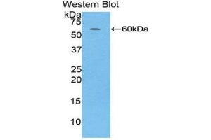Western Blotting (WB) image for anti-Complement Factor D (CFD) (AA 1-253) antibody (ABIN3205987) (Adipsin Antikörper  (AA 1-253))