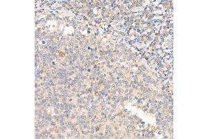 Immunohistochemistry of paraffin-embedded human tonsil using IL21 Rabbit pAb (ABIN6128086, ABIN6142359, ABIN6142360 and ABIN6223071) at dilution of 1:50 (40x lens). (IL-21 Antikörper  (AA 25-162))