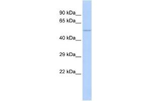 WB Suggested Anti-NFIC Antibody Titration:  1 ug/ml  Positive Control:  MCF-7 whole cell lysates (NFIC Antikörper  (Middle Region))