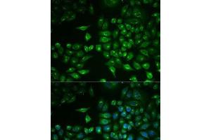 Immunofluorescence analysis of MCF7 cells using PLA2G2D Polyclonal Antibody (PLA2G2D Antikörper)