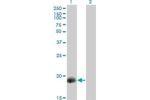 CPI-17 anticorps  (AA 1-147)