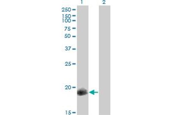 CPI-17 anticorps  (AA 1-147)