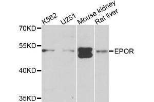 Western blot analysis of extracts of various cell lines, using EPOR antibody (ABIN5971509) at 1/1000 dilution. (EPOR Antikörper)