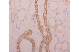 IHC-P analysis of Kidney tissue, with DAB staining. (NKp44/NCR2 Antikörper  (AA 22-120))
