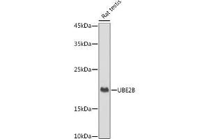 Western blot analysis of extracts of Rat testis, using UBE2B antibody (ABIN7271173) at 1:1000 dilution. (UBE2B Antikörper)