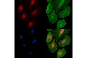 ABIN6260038 and ABIN6278666 staining  cells by IF/ICC.