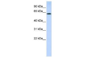 Western Blotting (WB) image for anti-Tripartite Motif Containing 55 (TRIM55) antibody (ABIN2458740) (TRIM55 Antikörper)