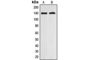 Western blot analysis of EIF5B expression in A549 (A), Jurkat (B) whole cell lysates.