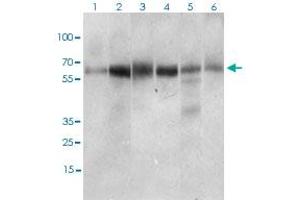 Western blot analysis of Lane 1: Hela cell lysate; Lane 2: Jurkat cell lysate; Lane 3: HEK293 cell lysate; Lane 4: A431 cell lysate; Lane 5: HepG2 cell lysate; Lane 6: RAJI cell lysate with CTNNBL1 monoclonal antibody, clone 1E4F5  at 1:500-1:2000 dilution. (CTNNBL1 Antikörper  (AA 390-557))